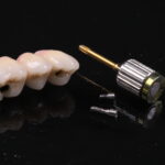 Cirurgia guiada ganha força — com pontos de atenção sobre artefatos do CBCT