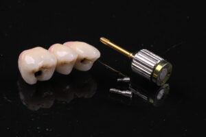 Cirurgia guiada ganha força — com pontos de atenção sobre artefatos do CBCT